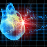 A graphic of a heart with an implantable device attached.