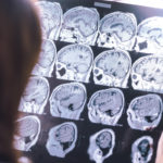 Brain Scan