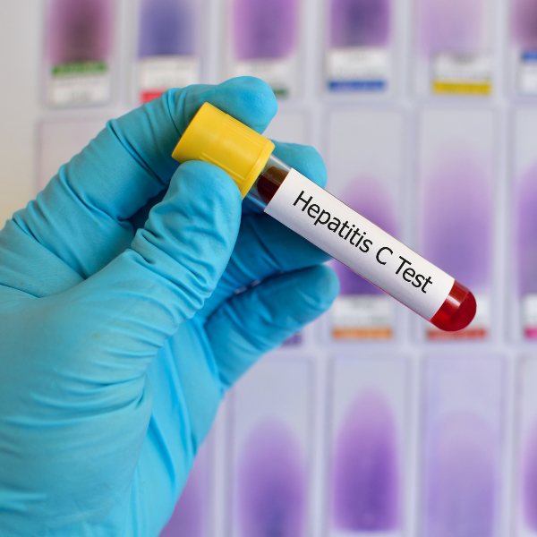 Hepatitis C Test