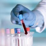 A blood test in a lab