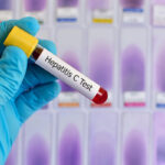 A test-tube labelled 'Hepatitis C Test' being held by a healthcare worker.