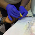 Finger prick test